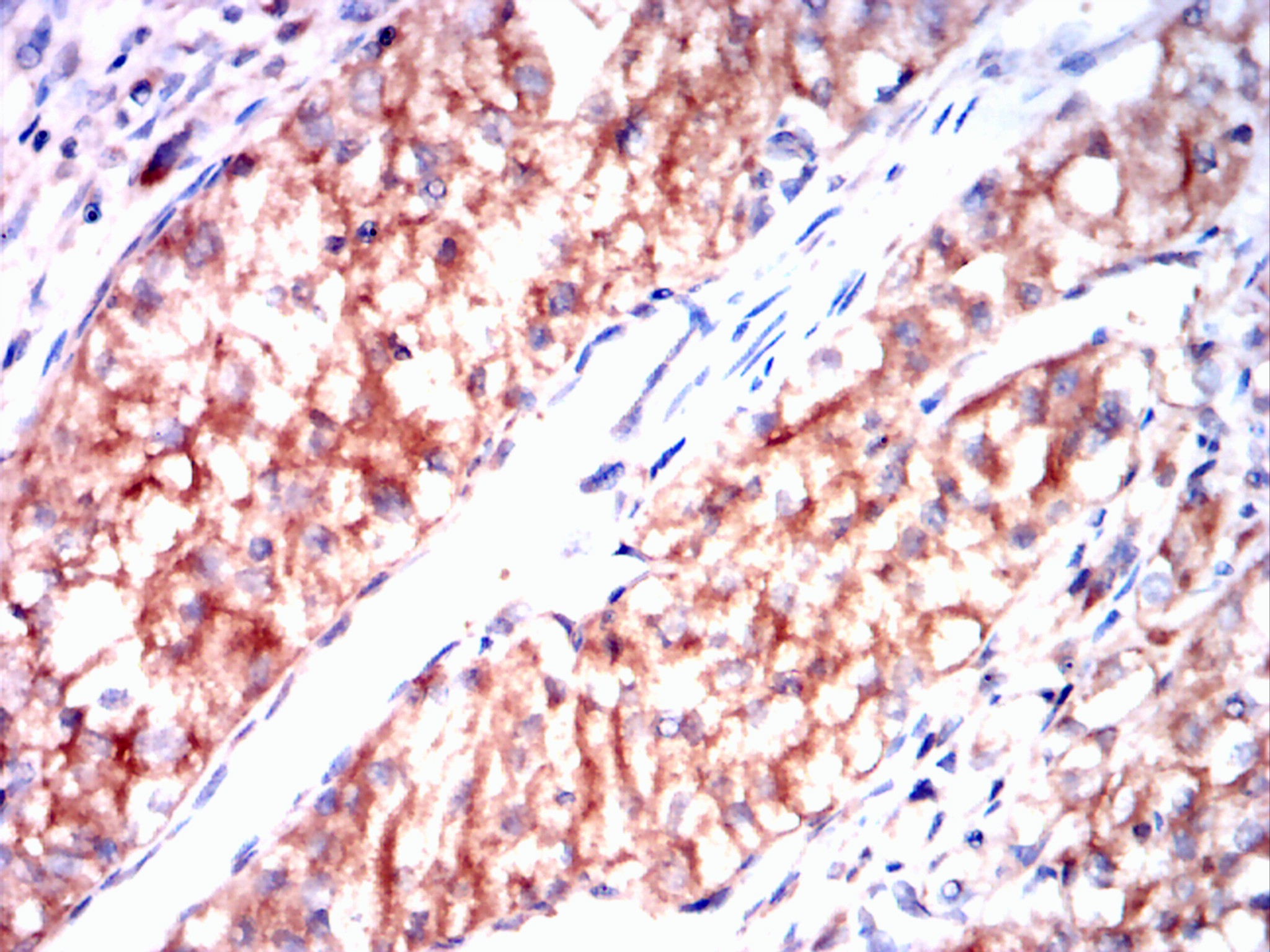                   IHC